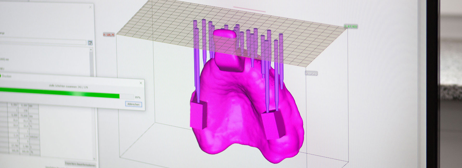 CAD-Darstellung eines Backenzahnes